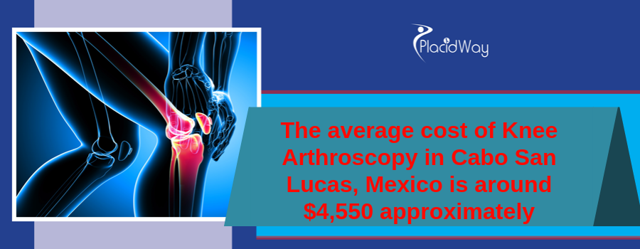 The average cost of Knee Arthroscopy in Cabo San Lucas, Mexico is around $4,550 approximately